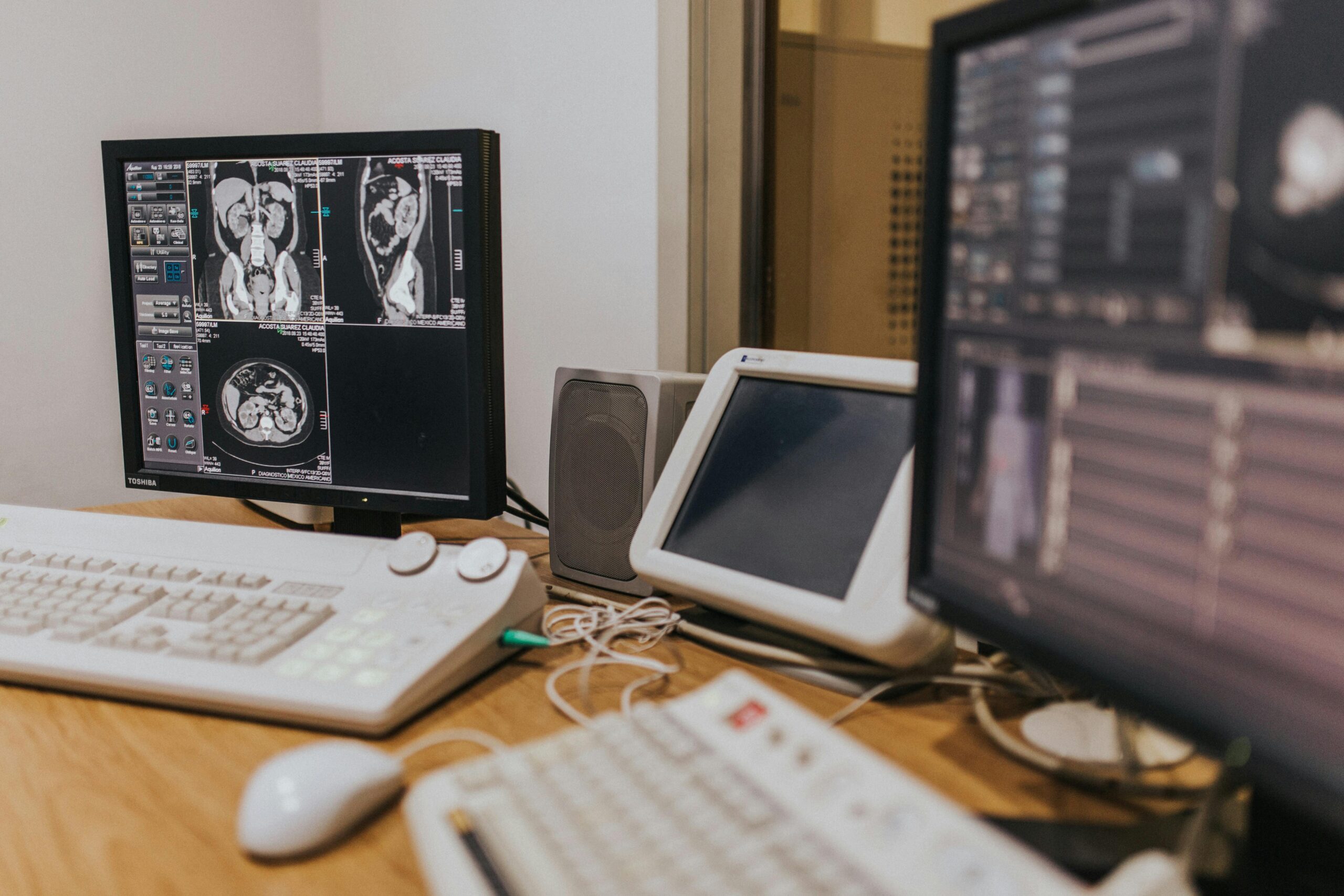 MRI Workflow Optimization