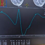 Healthcare Imaging Consultancy