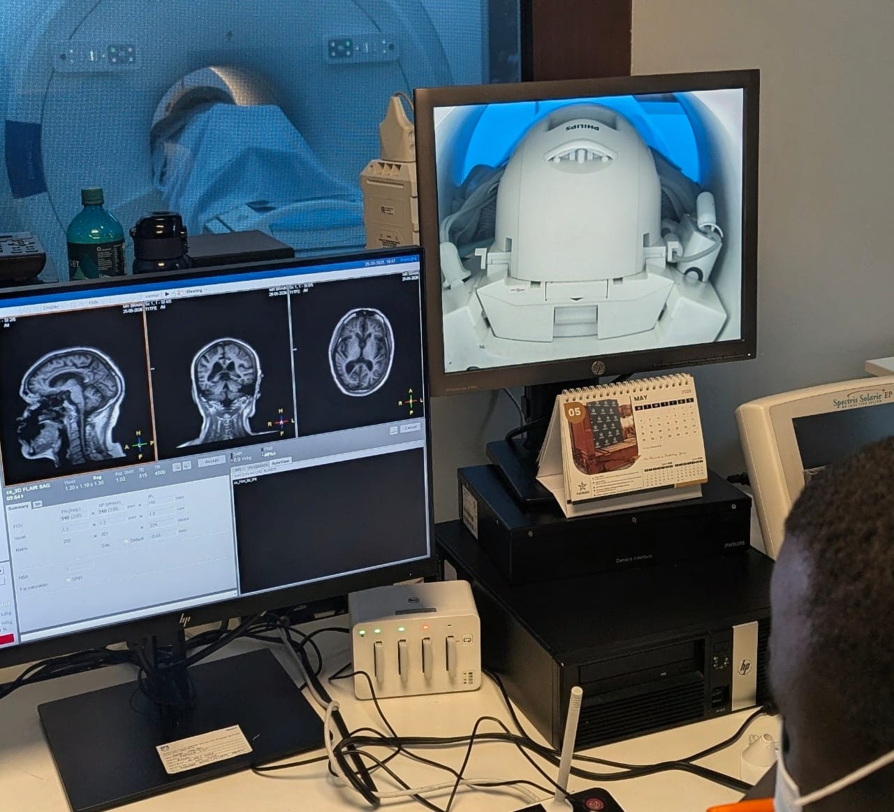 MRI Equipment Procurement Strategy